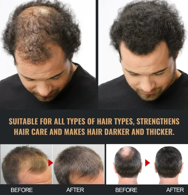 Root Activator Hair Regrowth Shampoo